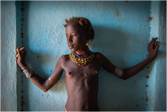 Etiopia